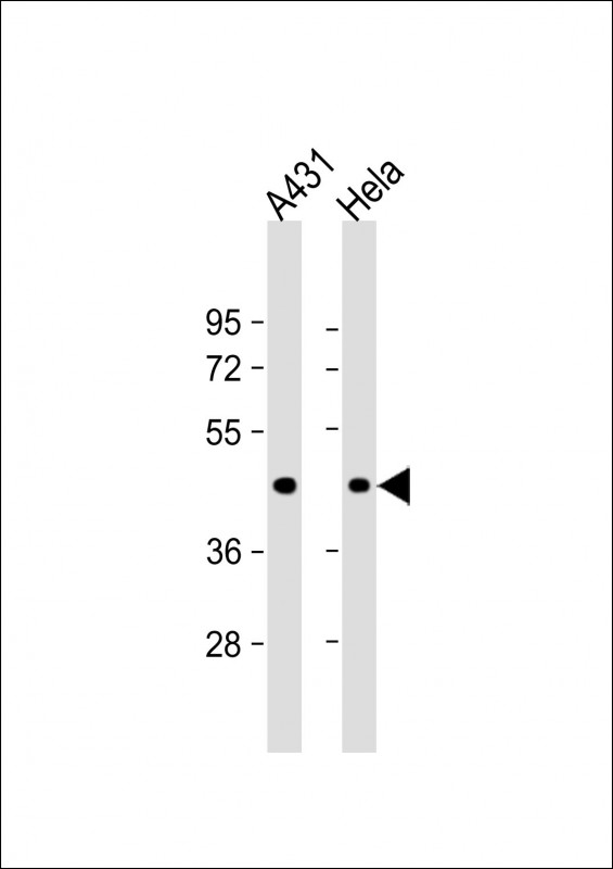 Lane 1: A431; Lane 2: HeLa lysate at 20 µg per lane, probed with bsm-51104M ACTA1 (337CT30.10.1) Monoclonal Antibody at 1:1000 dilution and 4℃ overnight incubation, followed by secondary antibody incubation for 60min at room temperature.