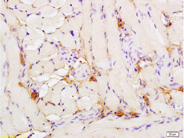 Formalin-fixed and paraffin embedded rat tongue tissue labeled with Anti-phospho-Nrf2 (Ser40) Polyclonal Antibody (bs-2013R), Unconjugated 1:200 followed by conjugation to the secondary  antibody and DAB staining