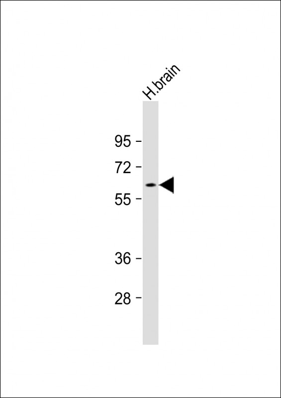 Human brain (20µg) probed with bsm-51143M GAD2 (458CT17.2.4) Monoclonal Antibody at 1:500 dilution and 4℃ overnight incubation, followed by secondary antibody incubation for 60min at room temperature.
