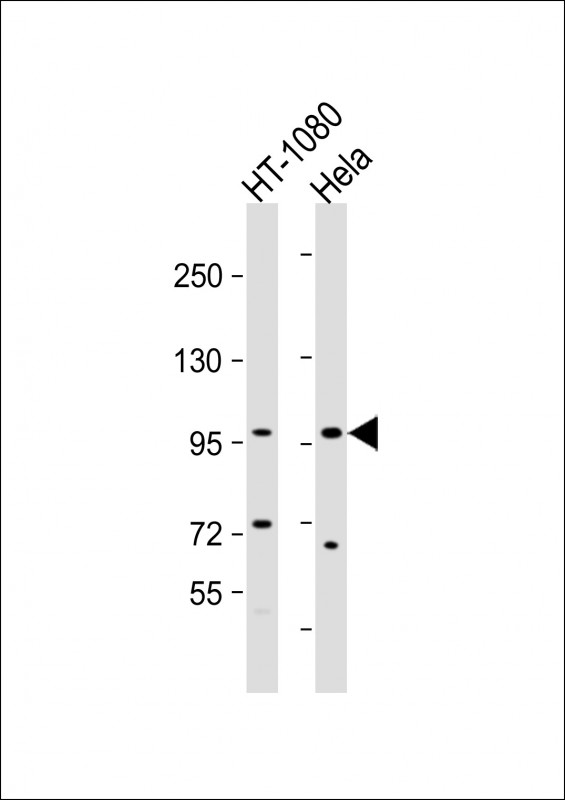 Lane 1: HT-1080; Lane 2: HeLa lysate at 20 µg per lane, probed with bsm-51161M TFRC (514CT23.4.1) Monoclonal Antibody at 1:1000 dilution and 4℃ overnight incubation, followed by secondary antibody incubation for 60min at room temperature.