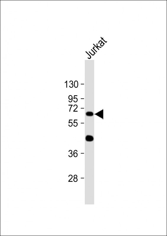 Jurkat lysate (20µg) probed with bsm-51210M CYP1A1 (10G3) Monoclonal Antibody at 1:1000 dilution and 4℃ overnight incubation, followed by secondary antibody incubation for 60min at room temperature.