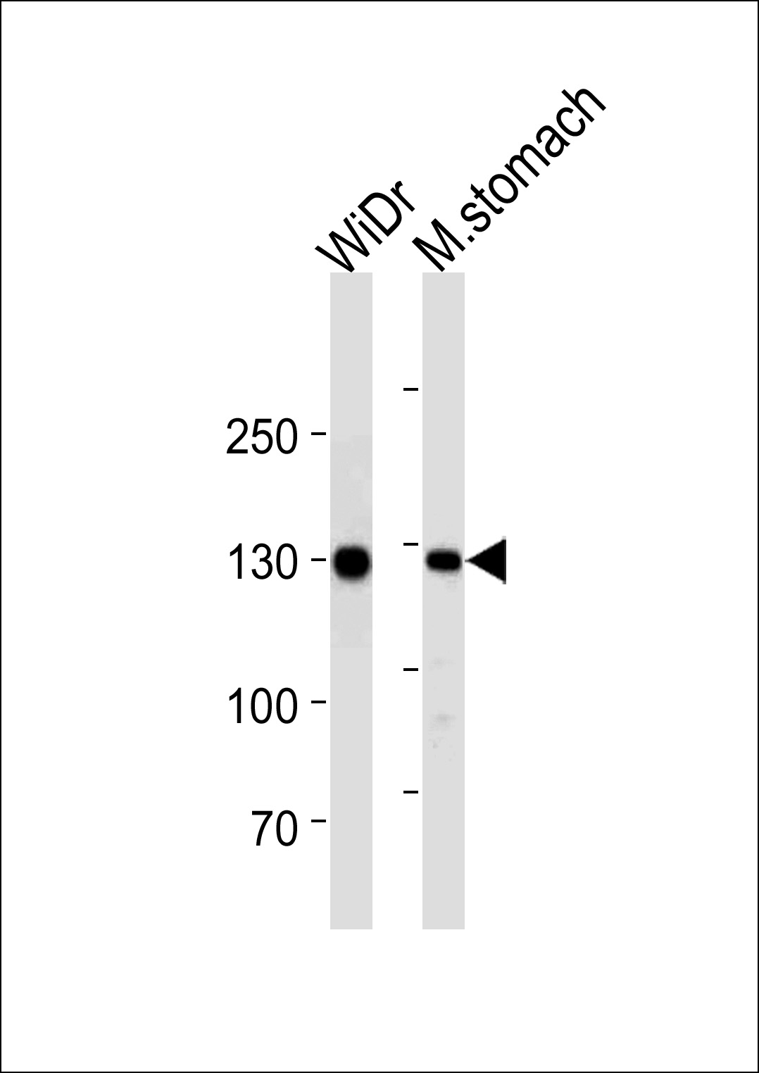 Lane 1: WiDr; Lane 2: mouse stomach lysate at 20 µg per lane, probed with bsm-51214M CDH1 (813CT11.1.3) Monoclonal Antibody at 1:1000 dilution and 4℃ overnight incubation, followed by secondary antibody incubation for 60min at room temperature.