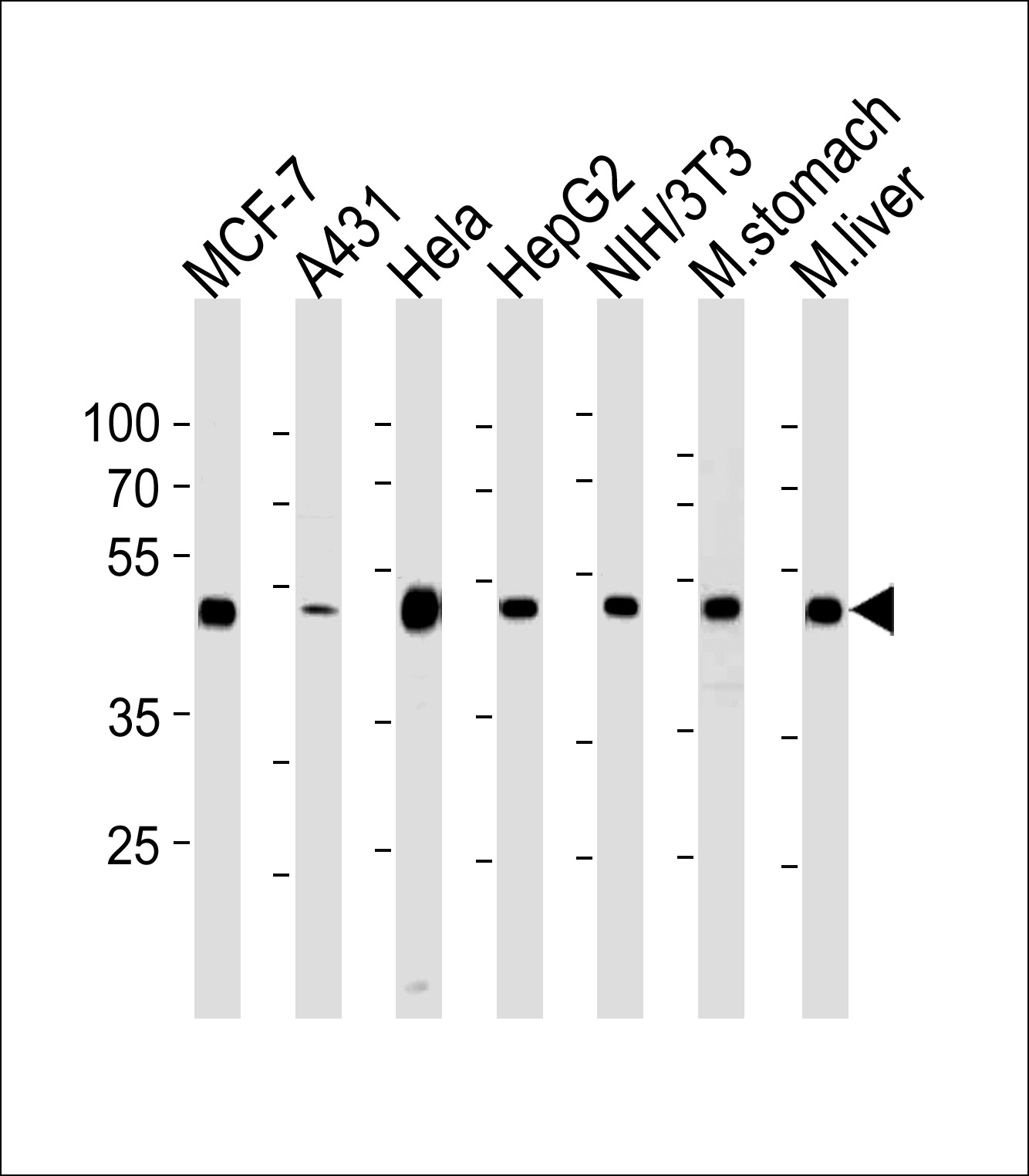 Lane 1: MCF-7; Lane 2: A431; Lane 3: HeLa; Lane 4: HepG2; Lane 5: NIH/3T3; Lane 6: mouse stomach; Lane 7: mouse liver lysate at 35 µg per lane. probed with bsm-51216M ENO1 (7C4) Monoclonal Antibody at 1:1000 dilution and 4℃ overnight incubation, followed by secondary antibody incubation for 60min at room temperature.