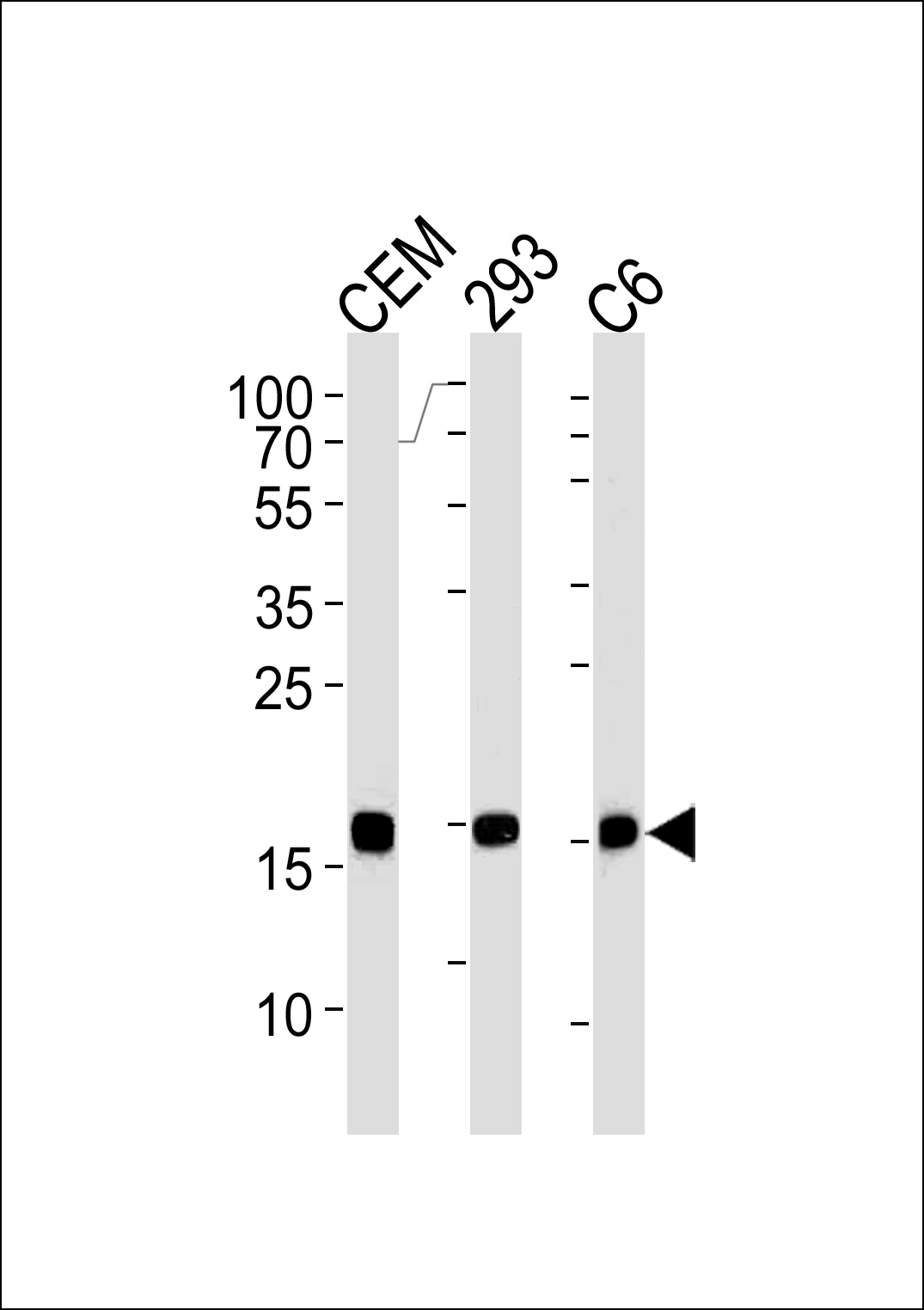 Lane 1: CEM Cell lysates; Lane 2: 293; Lane 3: C6 probed with bsm-51241M SUMO2 (7A3) Monoclonal Antibody at 1:1000 overnight at 4°C followed by a conjugated secondary antibody for 60 minutes at 37°C. Lane 1: CEM Cell lysates; Lane 2: 293; Lane 3: C6 probed with bsm-51241M SUMO2 (7A3) Monoclonal Antibody at 1:1000 overnight at 4°C followed by a conjugated secondary antibody for 60 minutes at 37°C.