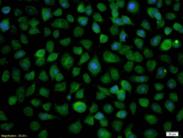 Formalin-fixed and paraffin-embedded human oral squamous cell labeled with Anti-RASSF1A Polyclonal Antibody, Unconjugated(bs-1234R) 1:200, overnight at 4\u00b0C, The secondary antibody was Goat Anti-Rabbit IgG, FITC conjugated(bs-0295G-FTIC)used at 1:200 dilution for 40 minutes at 37\u00b0C.