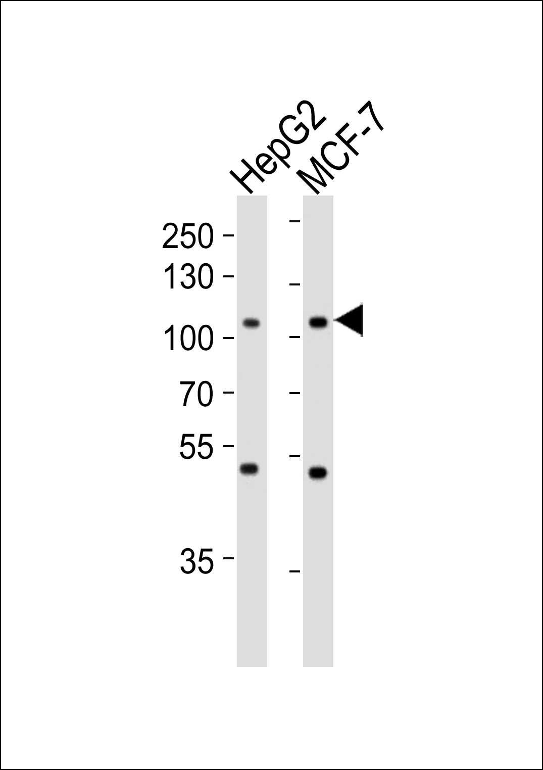 Lane 1: HepG2 Cell lysates; Lane 2: MCF-7 Cell lysates; probed with MAP4K3 (219CT8.3.1) Monoclonal Antibody, unconjugated (bsm-51067M) at 1:1000 overnight at 4°C followed by a conjugated secondary antibody for 60 minutes at 37°C.