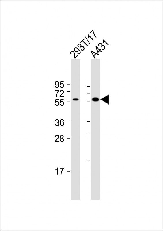 Lane 1: 293T; Lane 2: A431 probed with bsm-51265M PINK1 (38CT20.8.5) Monoclonal Antibody at 1:2000 overnight at 4°C followed by a conjugated secondary antibody for 60 minutes at 37°C.