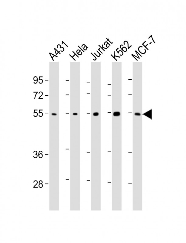 Lane 1: A431; Lane 2: HeLa; Lane 3: Jurkat; Lane 4: K562; Lane 5: MCF-7 cell lysates at 20ug per lane; probed with bsm-51266M CHK1 (2G1D5) Monoclonal Antibody at 1:1000 overnight at 4°C followed by a conjugated secondary antibody for 60 minutes at 37°C.