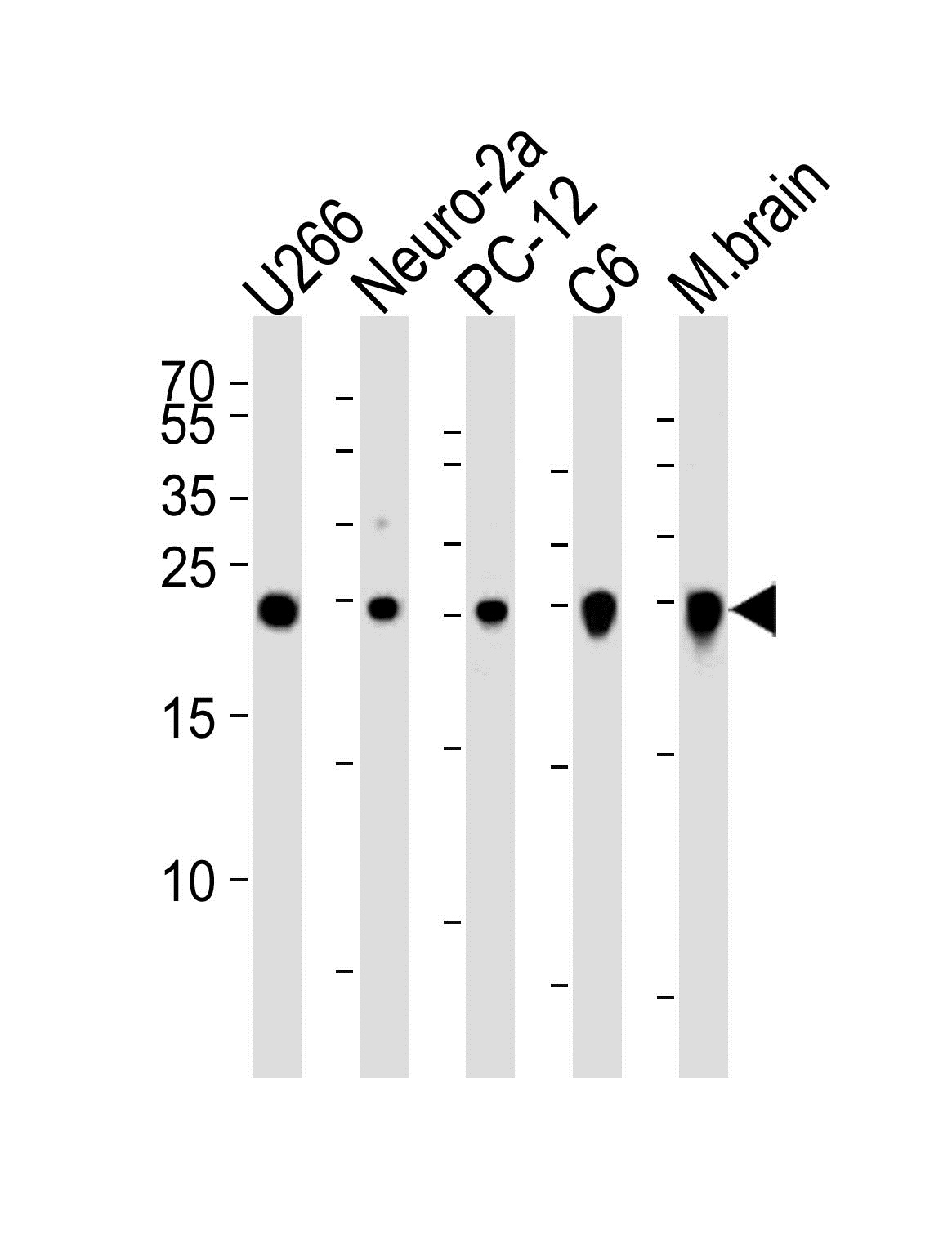 Lane 1: U266 Cell lysates; Lane 2: Neuro-2a Cell lysates; Lane 3: PC-12 Cell lysates; Lane 4: C6 Cell lysates; Lane 5: mouse brain lysates; probed with UCHL1 (346CT2.2.1) Monoclonal Antibody, unconjugated (bsm-51100M) at 1:1000 overnight at 4\u00b0C followed by a conjugated secondary antibody for 60 minutes at 37\u00b0C.