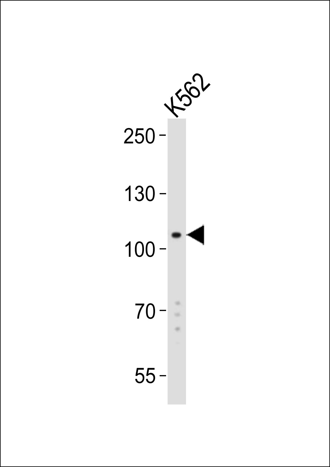 Lane 1: K562 Cell lysates; probed with LGR5/GPR49 (349CT16.1.3.1) Monoclonal Antibody, unconjugated (bsm-51116M) at 1:2000 overnight at 4°C followed by a conjugated secondary antibody for 60 minutes at 37°C.
