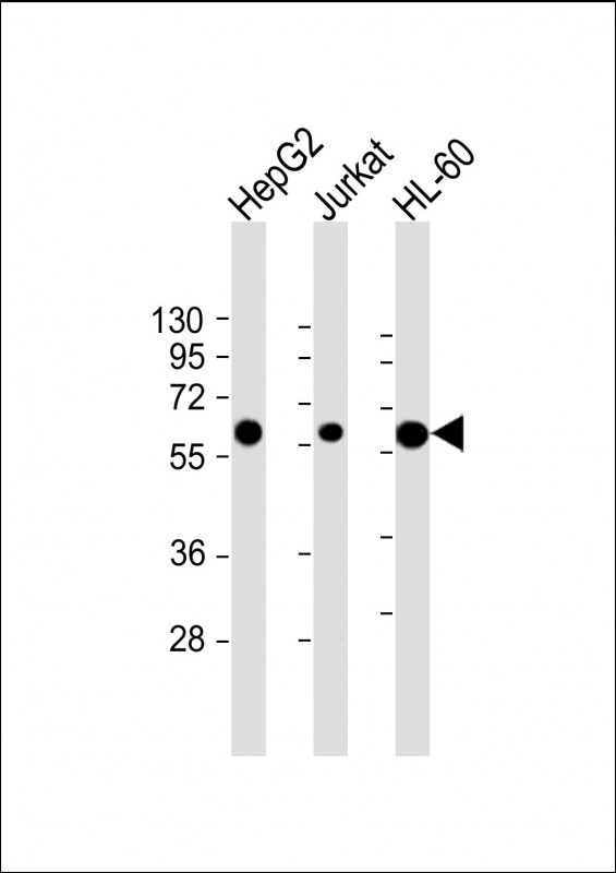 Lane 1: HepG2 Cell lysates; Lane 2: Jurkat Cell lysates; Lane 3: HL-60 Cell lysates; probed with CASP8 (550CT8.5.2) Monoclonal Antibody, unconjugated (bsm-51181M) at 1:2000 overnight at 4°C followed by a conjugated secondary antibody for 60 minutes at 37°C.