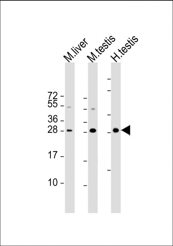Lane 1: mouse liver lysates; Lane 2: mouse testis lysates; Lane 3: human testis lysates; probed with CDX1 (937CT11.6.2) Monoclonal Antibody, unconjugated (bsm-51218M) at 1:1000 overnight at 4°C followed by a conjugated secondary antibody for 60 minutes at 37°C.