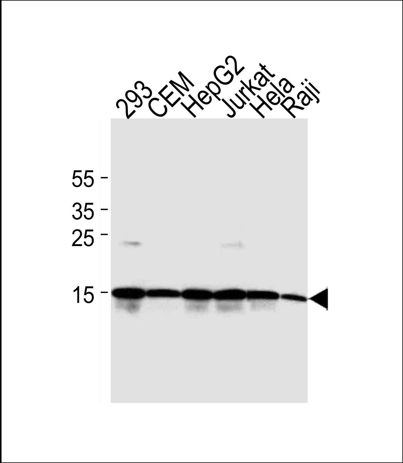Lane 1: 293 Cell lysates; Lane 2: CEM Cell lysates; Lane 3: HepG2 Cell lysates; Lane 4: Jurkat Cell lysates; Lane 5: HeLa Cell lysates; Lane 6: Raji Cell lysates; probed with H2AFX (8C5) Monoclonal Antibody, unconjugated (bsm-51222M) at 1:2000 overnight at 4°C followed by a conjugated secondary antibody for 60 minutes at 37°C. Lane 1: 293 Cell lysates; Lane 2: CEM Cell lysates; Lane 3: HepG2 Cell lysates; Lane 4: Jurkat Cell lysates; Lane 5: HeLa Cell lysates; Lane 6: Raji Cell lysates; probed with H2AFX (8C5) Monoclonal Antibody, unconjugated (bsm-51222M) at 1:2000 overnight at 4°C followed by a conjugated secondary antibody for 60 minutes at 37°C.