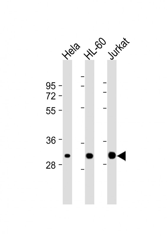 Lane 1: HeLa; Lane 2: HL-60; Lane 3: Jurkat cell lysate (20µg) probed with bsm-51309M CDK2 (4C6) Monoclonal Antibody at 1:2000 dilution and 4℃ overnight incubation, followed by secondary antibody incubation for 60min at room temperature.