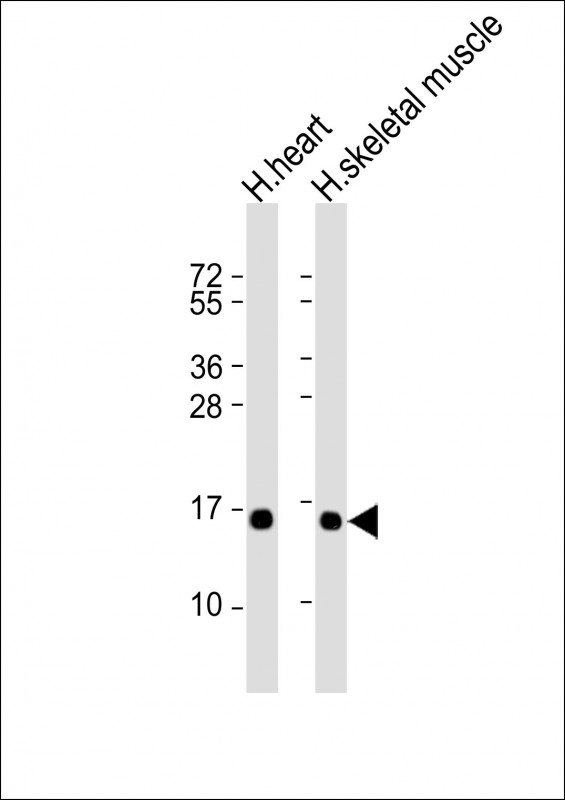 Lane 1: Human heart lysate; Lane 2; Human skeletal muscle lysate (20µg) probed with bsm-51317M TUSC2 (5C2) Monoclonal Antibody at 1:2000 dilution and 4℃ overnight incubation, followed by secondary antibody incubation for 60min at room temperature.