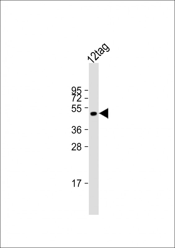 12-tag protein lysate (20µg) probed with bsm-51321M FLAG Tag (7C1) Monoclonal Antibody at 1:2000 dilution and 4℃ overnight incubation, followed by secondary antibody incubation for 60min at room temperature.