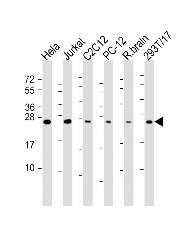 Lane 1: HeLa; Lane 2: Jurkat; Lane 3: C2C12; Lane 4: PC-12; Lane 5: rat brain; Lane 6: 293T/17 lysates (20µg) probed with bsm-51322M RAB11A (6C8) Monoclonal Antibody at 1:4000 dilution and 4℃ overnight incubation, followed by secondary antibody incubation for 60min at room temperature.