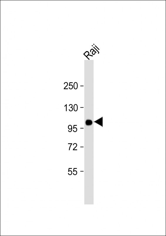 Raji cell lysate (20µg) probed with bsm-51327M VAV1 (2C8) Monoclonal Antibody at 1:4000 dilution and 4℃ overnight incubation, followed by secondary antibody incubation for 60min at room temperature.
