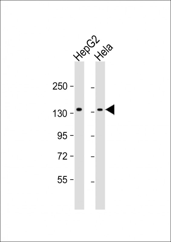 Lane 1: HepG2; Lane 2: HeLa cell lysate (20µg) probed with bsm-51328M RBM6 (3C7) Monoclonal Antibody at 1:1000 dilution and 4℃ overnight incubation, followed by secondary antibody incubation for 60min at room temperature.