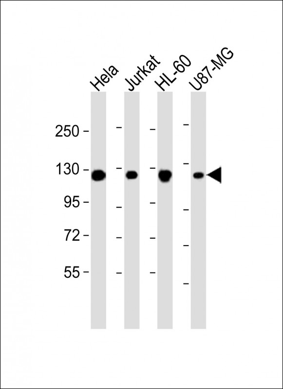 Lane 1: Hela; Lane 2: Jurkat; Lane 3: HL-60; Lane 4: U87-MG lysate (20µg) per lane, probed with bsm-51332M RNF20 (4C6) Monoclonal Antibody at 1:2000 dilution and 4℃ overnight incubation, followed by secondary antibody incubation for 60min at room temperature.