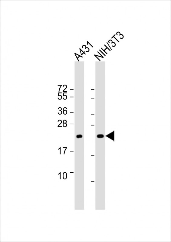 Lane 1: A431; Lane 2: HIN/3T3 lysate (20µg per lane) probed with bsm-51335M RRAS2 (15C4) Monoclonal Antibody at 1:4000 dilution and 4℃ overnight incubation, followed by secondary antibody incubation for 60min at room temperature.