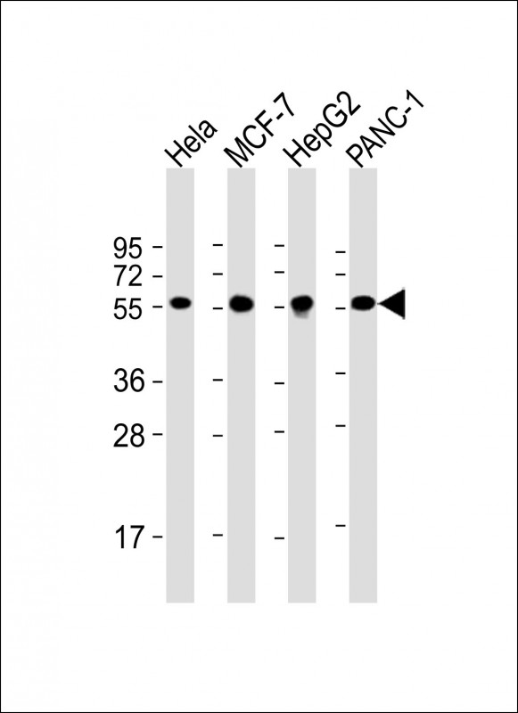 Lane 1: HeLa; Lane 2: MCF-7; Lane 3: HepG2; Lane 4: PANC-1 cell testis lysate (20µg) probed with bsm-51338M PDIA1 (3C3) Monoclonal Antibody at 1:4000 dilution and 4℃ overnight incubation, followed by secondary antibody incubation for 60min at room temperature.