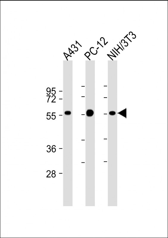 Lane 1: A431; Lane 2: PC-12; Lane 3: NIH/3T3 cell lysate (20µg per lane) probed with bsm-51339M MITF (M2A1) Monoclonal Antibody at 1:2000 dilution and 4℃ overnight incubation, followed by secondary antibody incubation for 60min at room temperature.