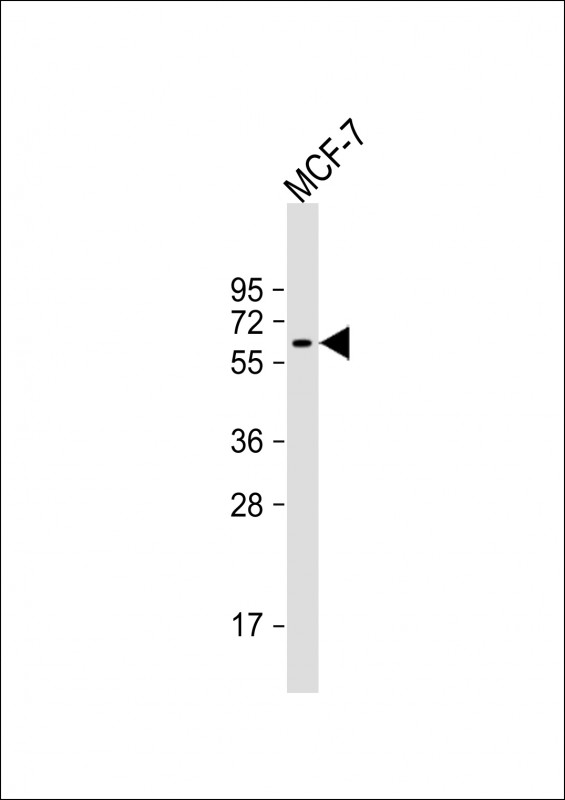 MCF-7 cell lysate (20µg) probed with bsm-51340M YES1 (1612CT505.7.50) Monoclonal Antibody at 1:4000 dilution and 4℃ overnight incubation, followed by secondary antibody incubation for 60min at room temperature.
