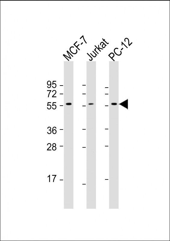 Lane 1: MCF-7; Lane 2: Jurkat; Lane 3: PC-12 cell lysate (20µg per lane) probed with bsm-51346M AKT2 (1623CT791.157.67.66) Monoclonal Antibody at 1:1000 dilution and 4℃ overnight incubation, followed by secondary antibody incubation for 60min at room temperature.
