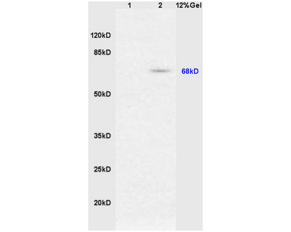 L1 mouse heart, L2 mouse muscle lysates probed (bs-2013R) at 1:200 in 4˚C. Followed by conjugation to secondary antibody (bs-0295G-HRP) at 1:3000 90min in 37˚C. The specific protein band has also been reported to migrate to around 100kDa. 