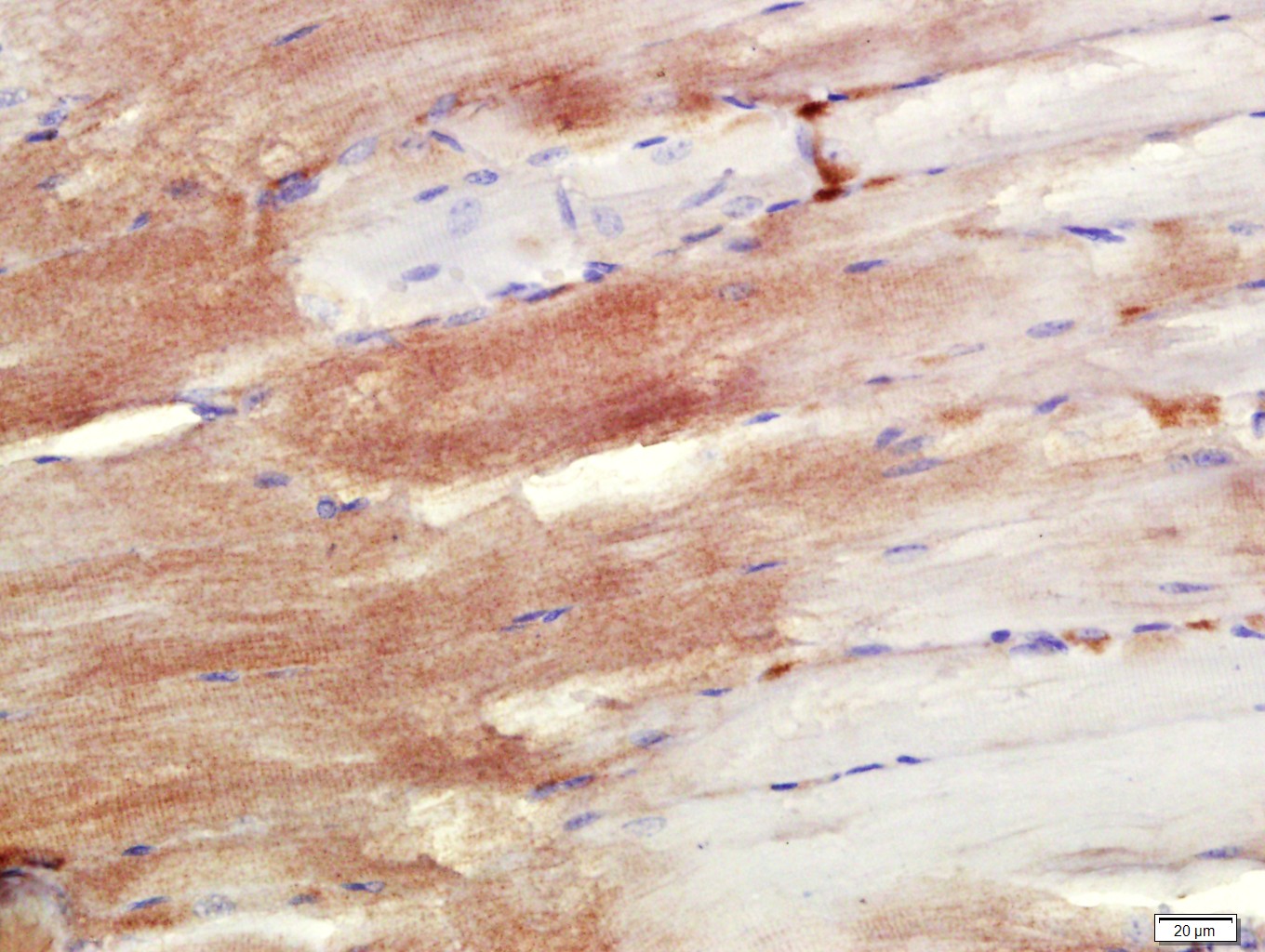 Paraformaldehyde-fixed, paraffin embedded Mouse skeletal muscle; Antigen retrieval by boiling in sodium citrate buffer (pH6.0) for 15min; Block endogenous peroxidase by 3% hydrogen peroxide for 20 minutes; Blocking buffer (normal goat serum) at 37°C for 30min; Antibody incubation with NDUFS7 Polyclonal Antibody, Unconjugated (bs-11734R) at 1:400 overnight at 4°C, followed by a conjugated secondary antibody for 20 minutes and DAB staining.