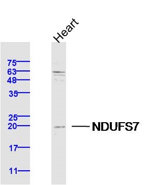 Lane 1: Mouse Heart lysates probed with NDUFS7 Polyclonal Antibody, Unconjugated (bs-11734R) at 1:300 overnight at 4˚C. Followed by a conjugated secondary antibody at 1:10000 for 60 min at 37˚C.