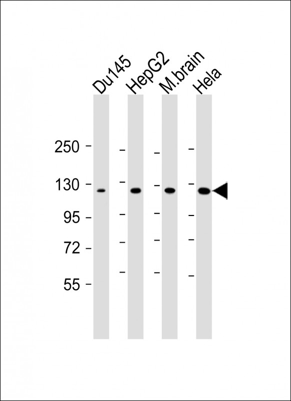 Lane 1: Du145; Lane 2: HepG2; Lane 3: mouse brain; Lane 4: Hela cell lysate at 20 µg per lane, probed with bsm-51347M DAB2IP (6C1) Monoclonal Antibody at 1:1000 dilution and 4℃ overnight incubation, followed by secondary antibody incubation for 60min at room temperature.