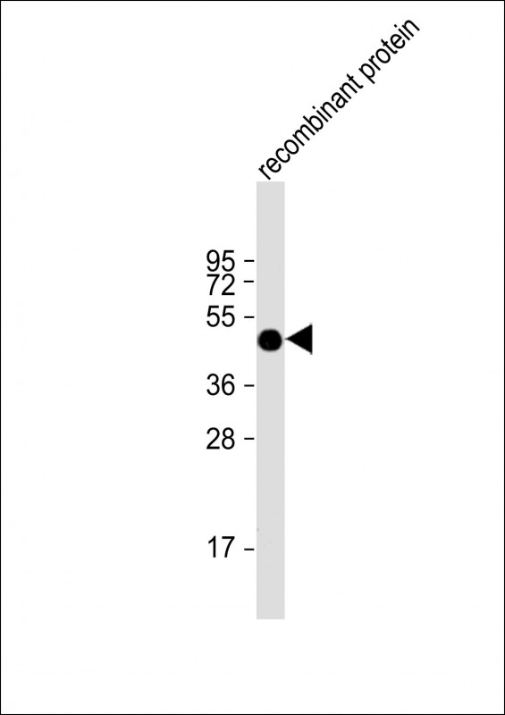 Human recombinant protein at 20 µg per lane, probed with bsm-51354M FAT1 (1634CT464.1.9) Monoclonal Antibody at 1:2000 dilution and 4℃ overnight incubation, followed by secondary antibody incubation for 60min at room temperature.