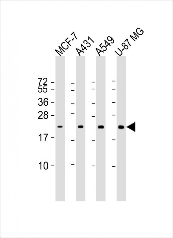 Lane 1: MCF-7; Lane 2: A431; Lane 3: A549; Lane 4: U-87MG cell lysate at 20 µg per lane, probed with bsm-51357M RAB13 (5C9) Monoclonal Antibody at 1:1000 dilution and 4℃ overnight incubation, followed by secondary antibody incubation for 60min at room temperature.