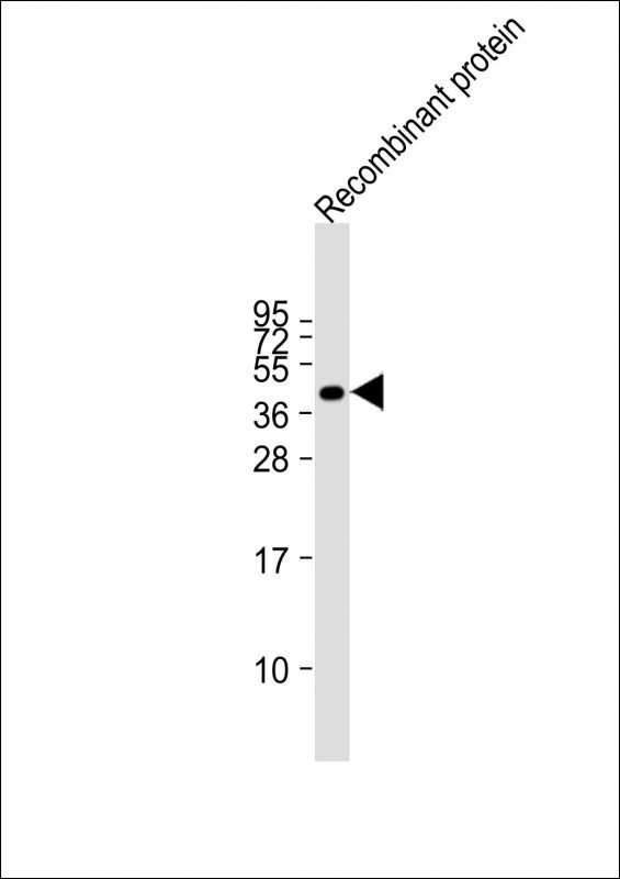 FAT4 recombinant protein at 20 µg per lane, probed with bsm-51360M FAT4 (1654CT645.1.70) Monoclonal Antibody at 1:2000 dilution and 4℃ overnight incubation, followed by secondary antibody incubation for 60min at room temperature.