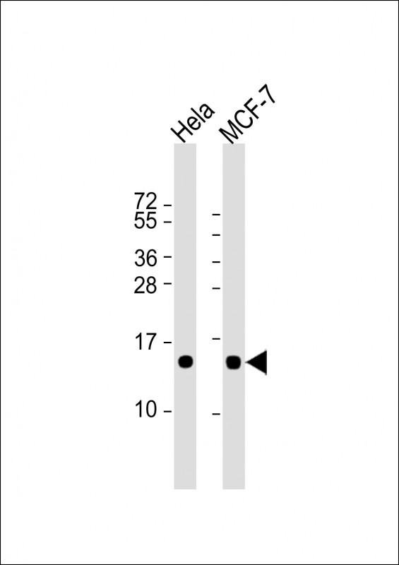 Lane 1: HeLa; Lane 2: MCF-7 cell lysate at 20 µg per lane, probed with bsm-51373M ISG15 (1031CT2.8.3) Monoclonal Antibody at 1:8000 dilution and 4℃ overnight incubation, followed by secondary antibody incubation for 60min at room temperature.