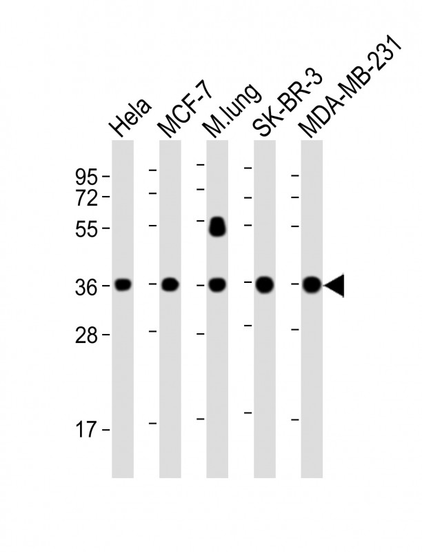 Lane 1: HeLa; Lane 2: MCF-7; Lane 3: mouse lung; Lane 4: SK-BR-3; Lane 5: MDA-MB-231 cell lysate at 20 µg per lane, probed with bsm-51380M WNT4 (8C5) Monoclonal Antibody at 1:4000 dilution and 4℃ overnight incubation, followed by secondary antibody incubation for 60min at room temperature.