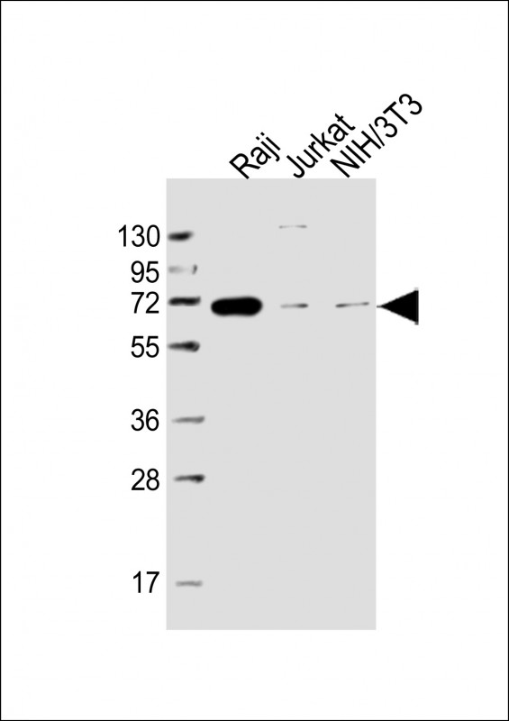 Lane 1: Raji; Lane 2: Jurkat; Lane 3: NIH/3T3 cell lysate at 20 µg per lane, probed with bsm-51381M RELB (4C5) Monoclonal Antibody at 1:5000 dilution and 4℃ overnight incubation, followed by secondary antibody incubation for 60min at room temperature.