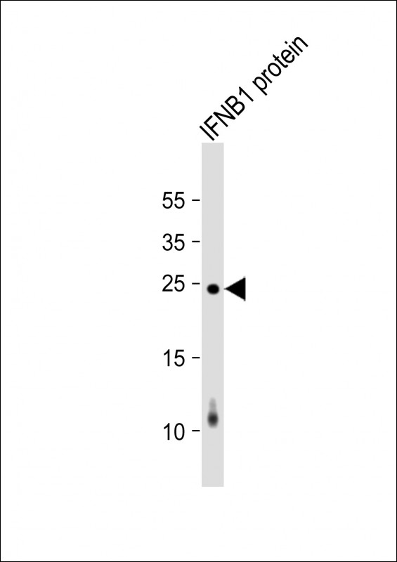 IFNB1 recombinant protein cell lysate at 20 µg per lane, probed with bsm-51383M IFNB1 (4C3) Monoclonal Antibody at 1:2000 dilution and 4℃ overnight incubation, followed by secondary antibody incubation for 60min at room temperature.