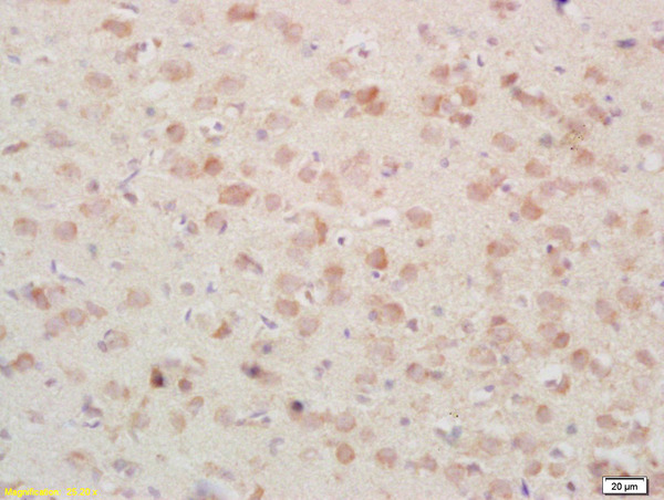 Formalin-fixed and paraffin embedded rat brain tissue labeled Anti-PSAP/PAP Polyclonal Antibody, Unconjugated (bs-1879R) at 1:200, followed by conjugation to the secondary antibody and DAB staining
