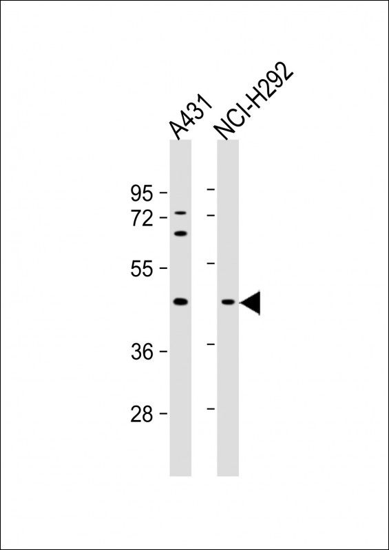 Lane 1: A431; Lane 2: NCI-H292 cell lysate at 20 µg per lane, probed with bsm-51386M SERPINB3 (7C2) Monoclonal Antibody at 1:4000 dilution and 4℃ overnight incubation, followed by secondary antibody incubation for 60min at room temperature.