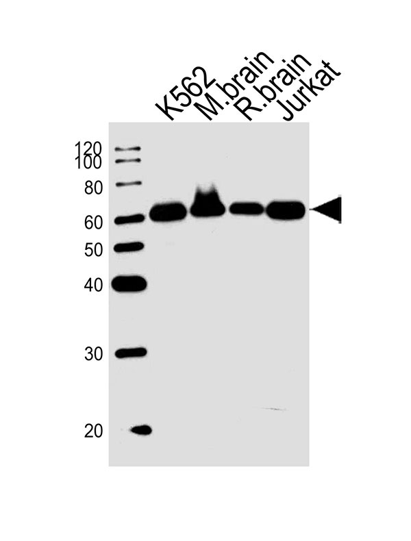 Lane 1: K562; Lane 2: mouse brain; Lane 3: rat brain; Lane 4: Jurkat cell lysate at 20 µg per lane, probed with bsm-51409M USP14 (9C1) Monoclonal Antibody at 1:1000 dilution and 4℃ overnight incubation, followed by secondary antibody incubation for 60min at room temperature.