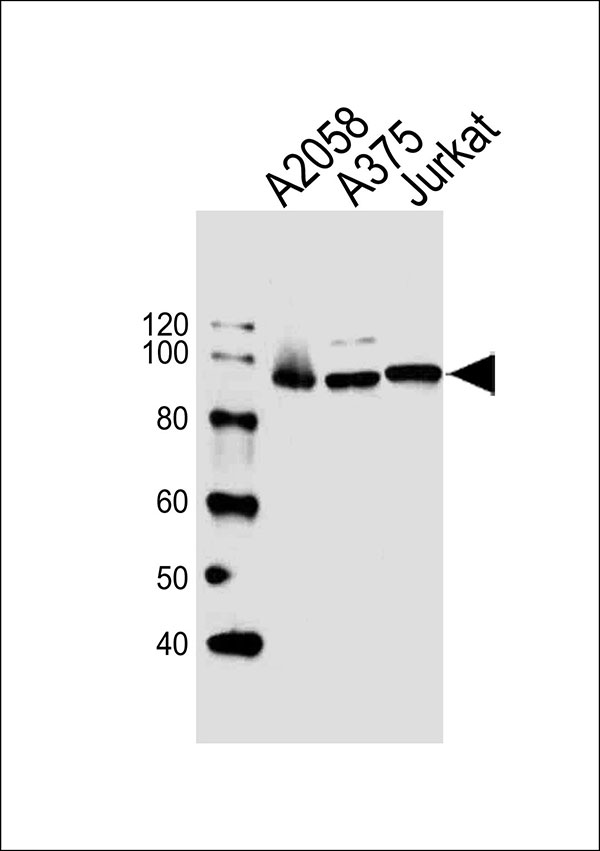 Lane 1: A2058; Lane 2: A375; Lane 3: Jurkat cell lysate at 20 µg per lane, probed with bsm-51428M MAGED1 (5C7) Monoclonal Antibody at 1:1000 dilution and 4℃ overnight incubation, followed by secondary antibody incubation for 60min at room temperature.
