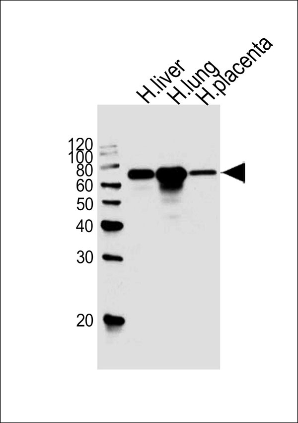 Lane 1: A431; Lane 2: HeLa cell lysate at 20 µg per lane, probed with bsm-51438M FLT1 (3C9) Monoclonal Antibody at 1:1000 dilution and 4℃ overnight incubation, followed by secondary antibody incubation for 60min at room temperature.