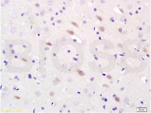 Formalin-fixed and paraffin-embedded : rat brain labeled with Rabbit Anti-NOS-2\/iNOS Polyclonal Antibody, Unconjugated(bs-2072R) 1:200 followed by conjugation to the secondary antibody and DAB staining