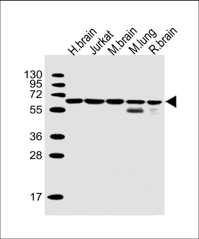 Lane 1: human brain; Lane 2: Jurkat; Lane 3: mouse brain; Lane 4: mouse lung; Lane 5: rat brain cell lysate at 20 µg per lane, probed with bsm-51443M PPP2R1B (1496CT356.164.25.226) Monoclonal Antibody at 1:1000 dilution and 4℃ overnight incubation, followed by secondary antibody incubation for 60min at room temperature.