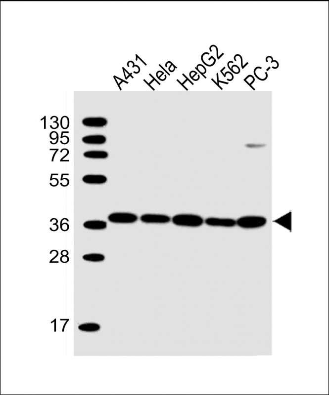 Lane 1: A431; Lane 2: HeLa; Lane 3: HepG2; Lane 4: K562; Lane 5: PC-3 cell lysate at 20 µg per lane, probed with bsm-51448M APEX1 (1518CT337.123.86.269.232) Monoclonal Antibody at 1:2000 dilution and 4℃ overnight incubation, followed by secondary antibody incubation for 60min at room temperature.
