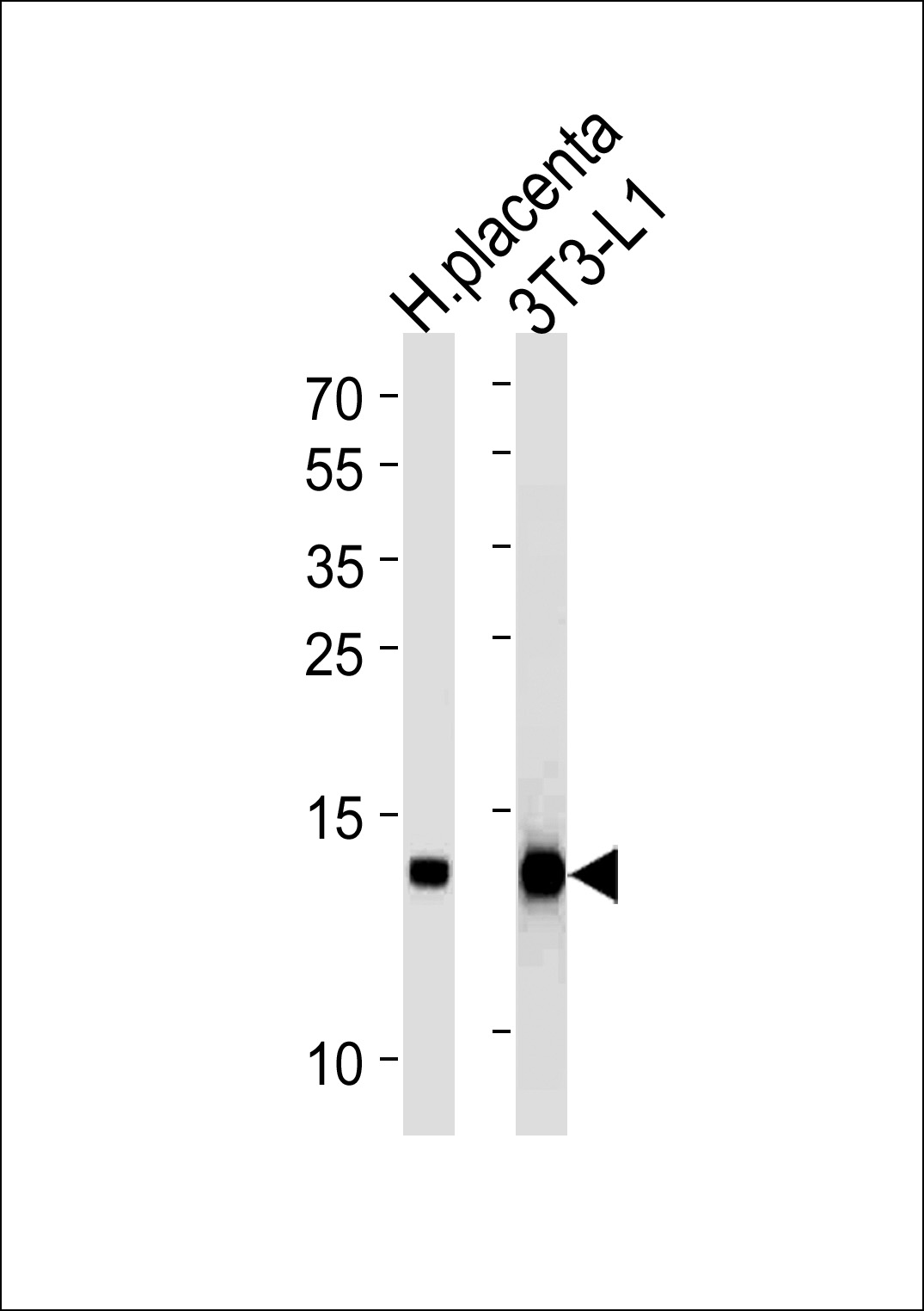 Lane 1: Human placenta lysates; Lane 2: 3T3-L1 Cell lysates; probed with FABP4 (1105CT1.1.1) Monoclonal Antibody, unconjugated (bsm-51247M) at 1:1000 overnight at 4°C followed by a conjugated secondary antibody for 60 minutes at 37°C. Lane 1: Human placenta lysates; Lane 2: 3T3-L1 Cell lysates; probed with FABP4 (1105CT1.1.1) Monoclonal Antibody, unconjugated (bsm-51247M) at 1:1000 overnight at 4°C followed by a conjugated secondary antibody for 60 minutes at 37°C.