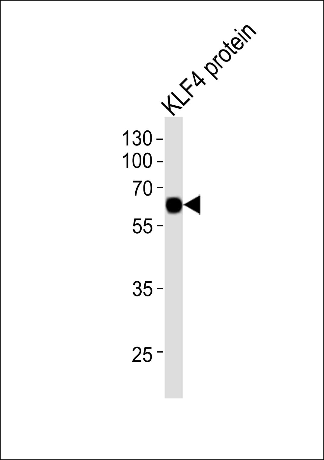 Lane 1: KLF4 protein; probed with KLF4 (5A1)  Monoclonal Antibody, unconjugated (bsm-51264M) at 1:2000 overnight at 4\u00b0C followed by a conjugated secondary antibody for 60 minutes at 37\u00b0C.